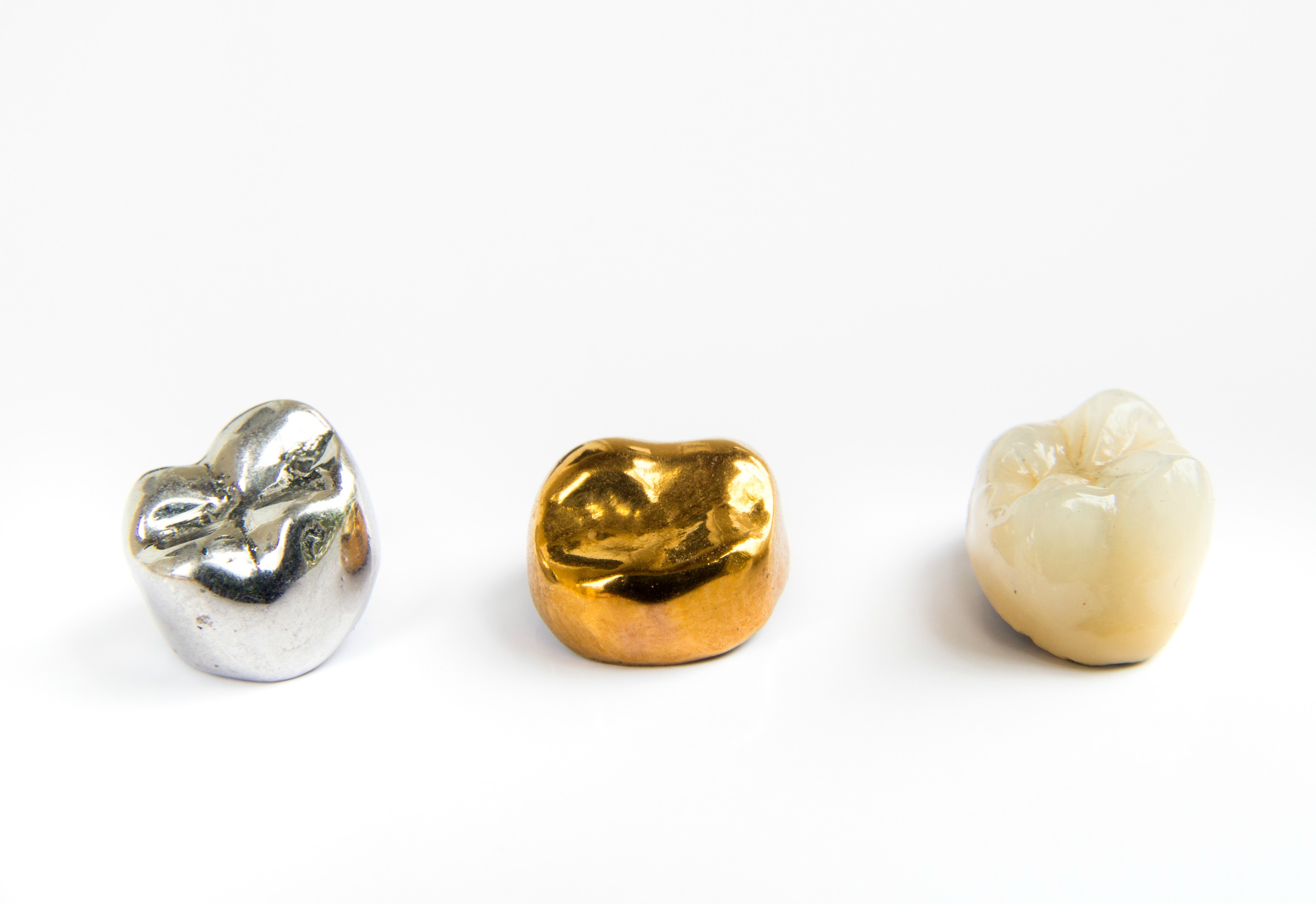 全金屬、全瓷冠、金屬烤瓷、全鋯冠，牙冠材質種類怎麼選？裝假牙牙套還會蛀牙嗎？ | 隱適美矯正中心